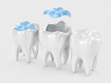 Is Your Gum Bleeding a Sign of Gingivitis? Here’s What to Know
